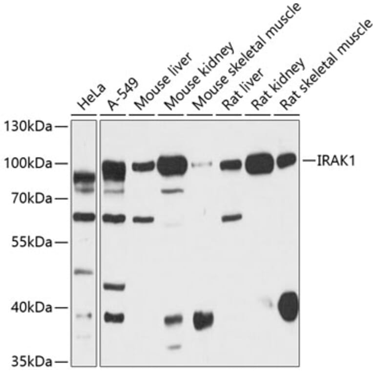 Western Blot - Anti-IRAK-1 Antibody (A87596) - Antibodies.com
