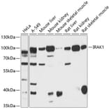 Western Blot - Anti-IRAK-1 Antibody (A87596) - Antibodies.com