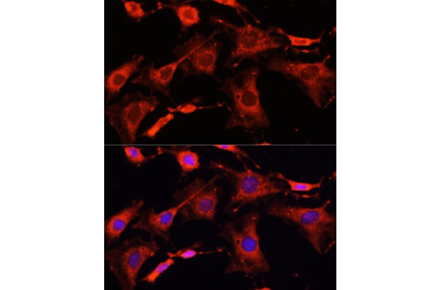 Immunofluorescence - Anti-IRAK-1 Antibody (A87596) - Antibodies.com