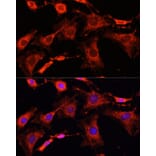 Immunofluorescence - Anti-IRAK-1 Antibody (A87596) - Antibodies.com