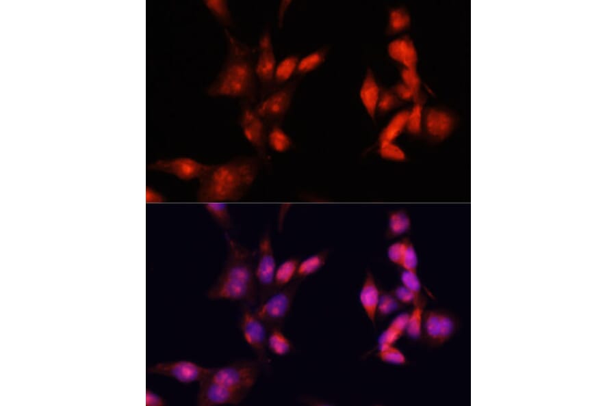 Immunofluorescence - Anti-IRAK-1 Antibody (A87596) - Antibodies.com