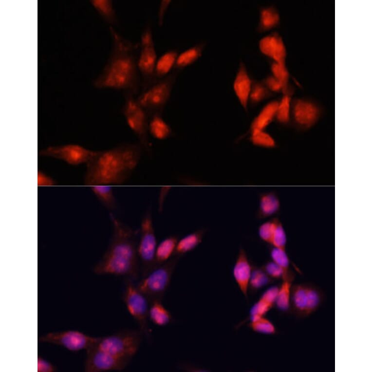 Immunofluorescence - Anti-IRAK-1 Antibody (A87596) - Antibodies.com
