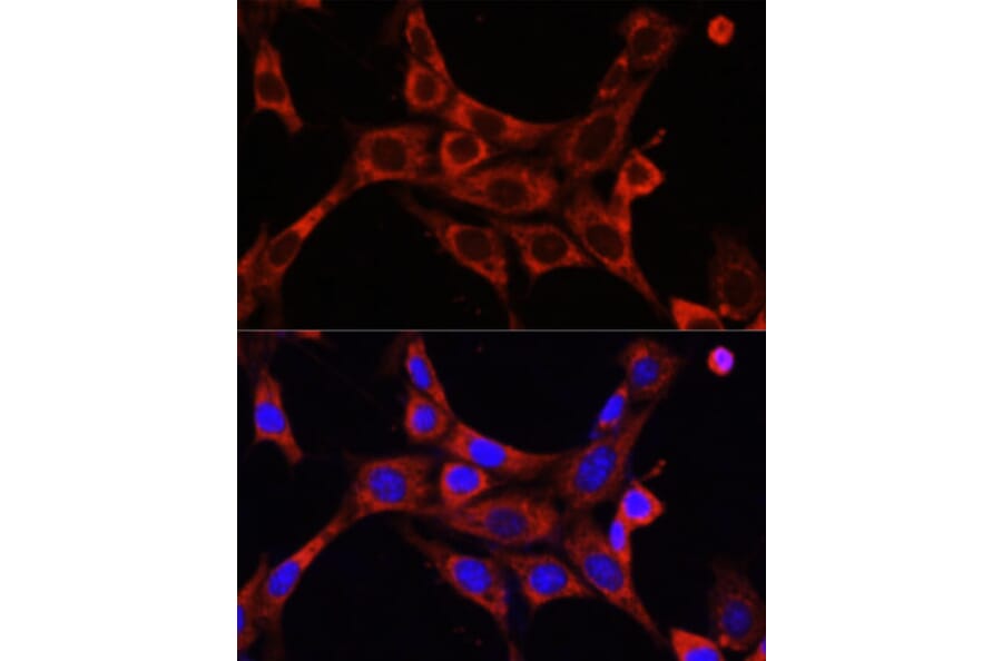 Immunofluorescence - Anti-IRAK-1 Antibody (A87596) - Antibodies.com
