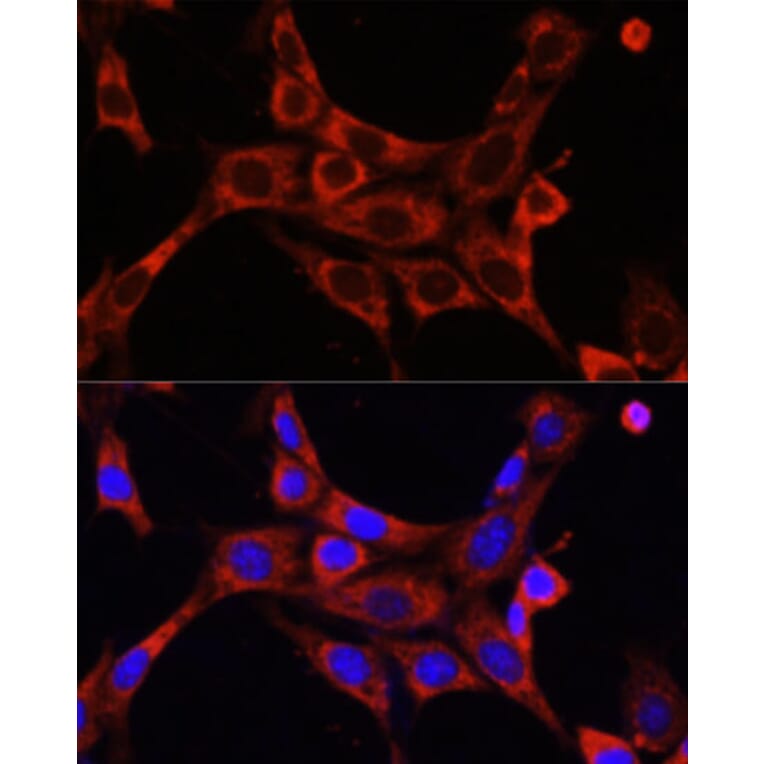 Immunofluorescence - Anti-IRAK-1 Antibody (A87596) - Antibodies.com