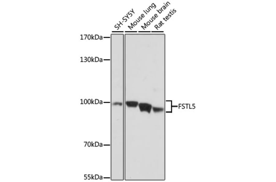 Western Blot - Anti-FSTL5 Antibody (A87597) - Antibodies.com