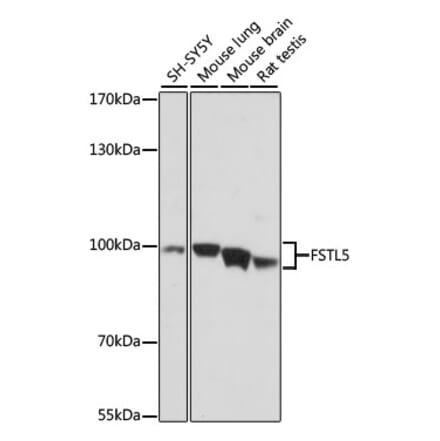 Western Blot - Anti-FSTL5 Antibody (A87597) - Antibodies.com