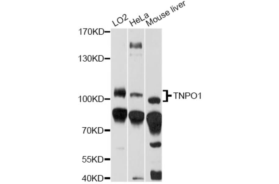 Western Blot - Anti-TNPO1 Antibody (A14015) - Antibodies.com