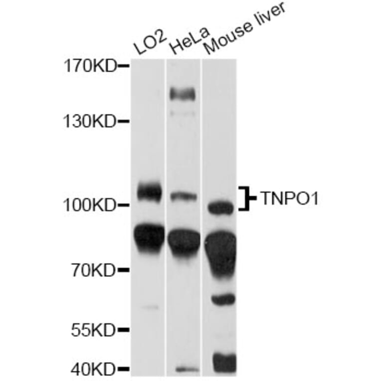 Western Blot - Anti-TNPO1 Antibody (A14015) - Antibodies.com