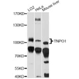 Western Blot - Anti-TNPO1 Antibody (A14015) - Antibodies.com