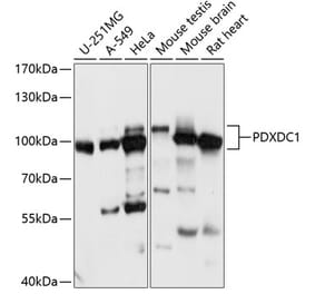 Western Blot - Anti-PDXDC1 Antibody (A87599) - Antibodies.com