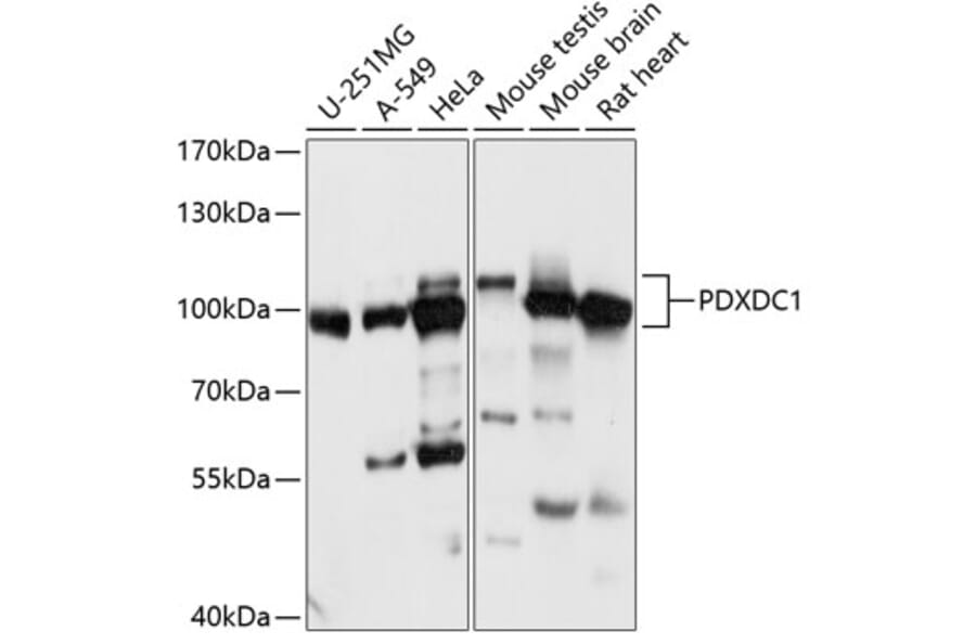 Western Blot - Anti-PDXDC1 Antibody (A87599) - Antibodies.com