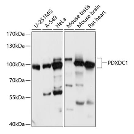 Western Blot - Anti-PDXDC1 Antibody (A87599) - Antibodies.com