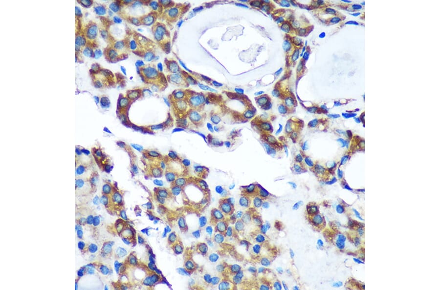 Immunohistochemistry - Anti-PDXDC1 Antibody (A87599) - Antibodies.com