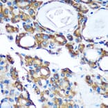 Immunohistochemistry - Anti-PDXDC1 Antibody (A87599) - Antibodies.com