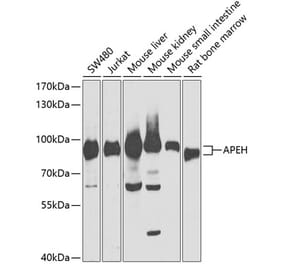 Western Blot - Anti-APH Antibody (A87600) - Antibodies.com