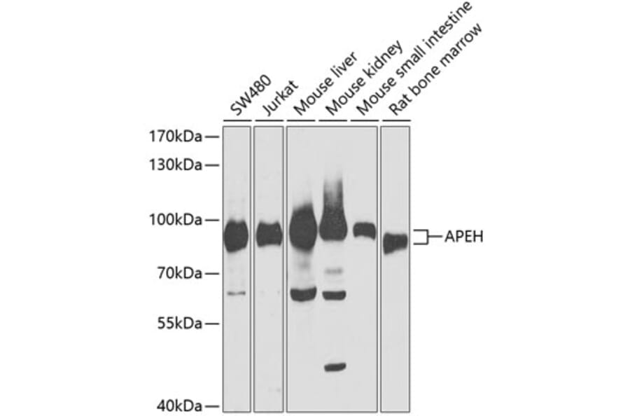 Western Blot - Anti-APH Antibody (A87600) - Antibodies.com