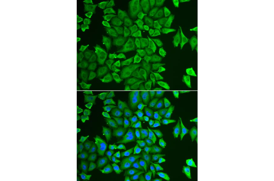 Immunofluorescence - Anti-APH Antibody (A87600) - Antibodies.com