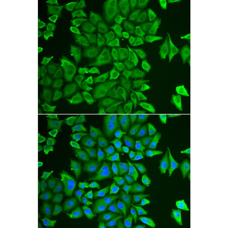 Immunofluorescence - Anti-APH Antibody (A87600) - Antibodies.com