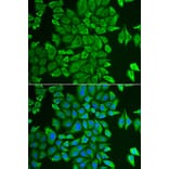 Immunofluorescence - Anti-APH Antibody (A87600) - Antibodies.com
