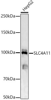 Western blot analysis of extracts of various cell lines, using Anti-SLC4A11 Antibody (A15910) at 1000 dilution.
Secondary antibody: Goat Anti-Rabbit IgG (H+L) (HRP) (AS014) at 1:10,000 dilution.
Lysates / proteins: 25µg per lane.
Blocking buffer: 3% non-fat dry milk in TBST.
Detection: ECL Basic Kit (RM00020).
Exposure time: 90s.