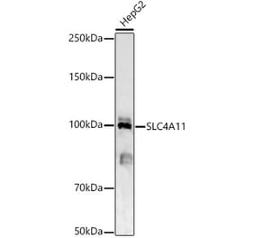 Western Blot - Anti-SLC4A11 Antibody (A87601) - Antibodies.com