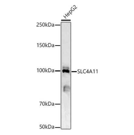 Western Blot - Anti-SLC4A11 Antibody (A87601) - Antibodies.com