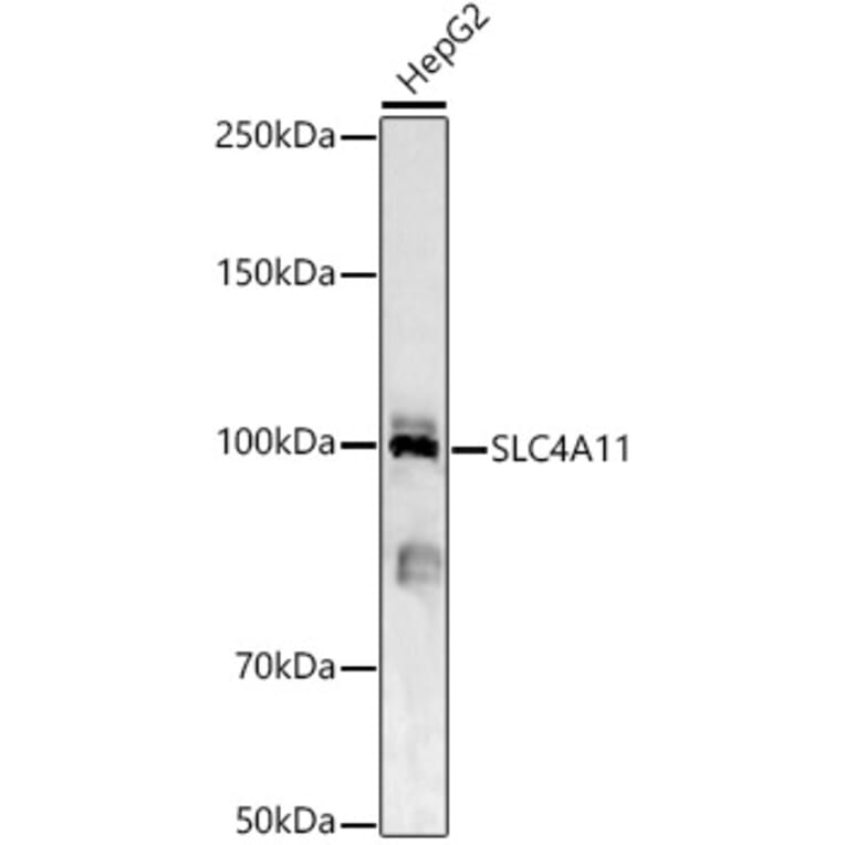 Western Blot - Anti-SLC4A11 Antibody (A87601) - Antibodies.com