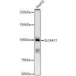 Western Blot - Anti-SLC4A11 Antibody (A87601) - Antibodies.com