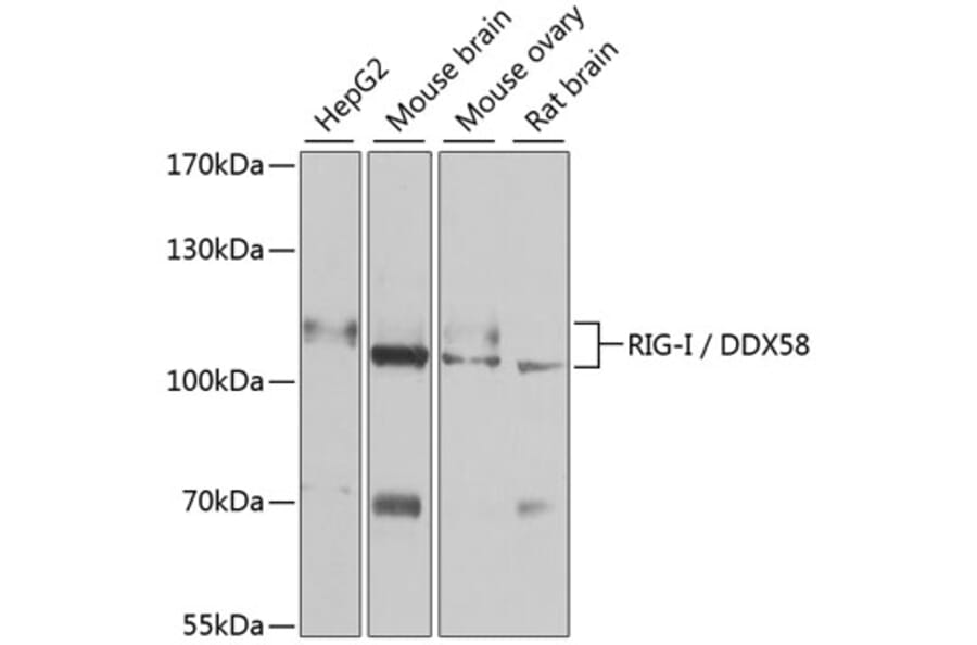Western Blot - Anti-RIG-I/DDX58 Antibody (A87602) - Antibodies.com