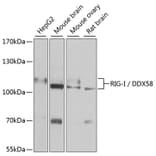 Western Blot - Anti-RIG-I/DDX58 Antibody (A87602) - Antibodies.com