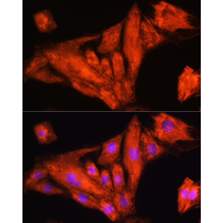 Immunofluorescence - Anti-RIG-I/DDX58 Antibody (A87602) - Antibodies.com