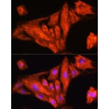 Immunofluorescence - Anti-RIG-I/DDX58 Antibody (A87602) - Antibodies.com