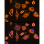 Immunofluorescence - Anti-RIG-I/DDX58 Antibody (A87602) - Antibodies.com