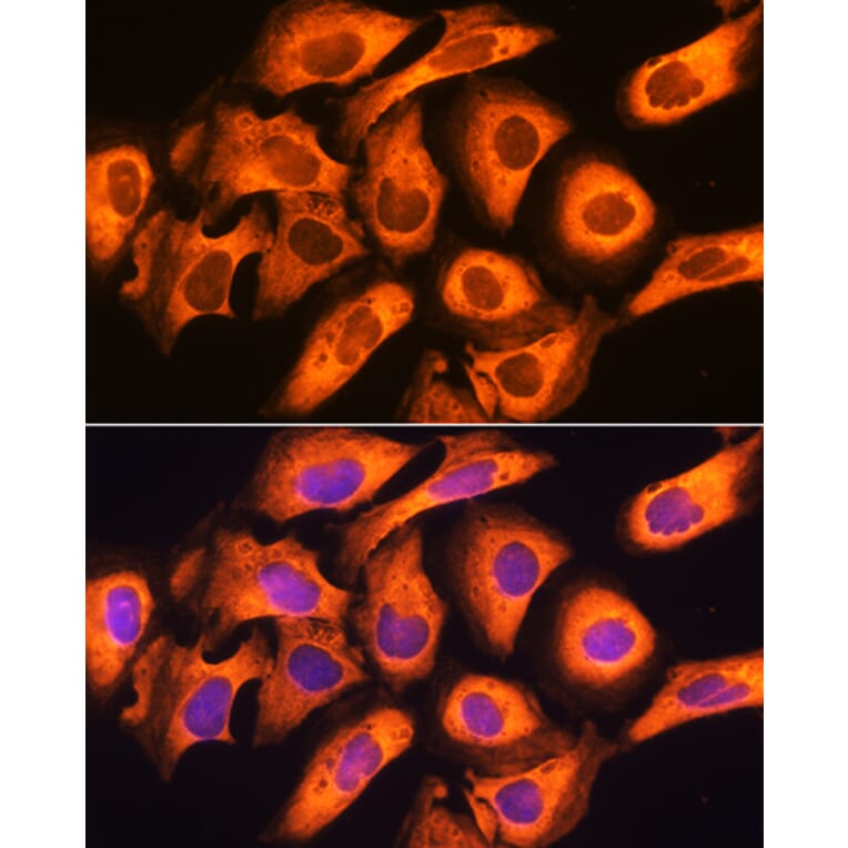 Immunofluorescence - Anti-RIG-I/DDX58 Antibody (A87602) - Antibodies.com