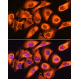 Immunofluorescence - Anti-RIG-I/DDX58 Antibody (A87602) - Antibodies.com