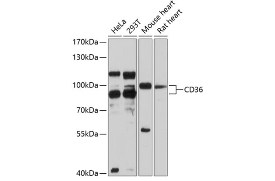 Western Blot - Anti-CD36 Antibody (A1470) - Antibodies.com