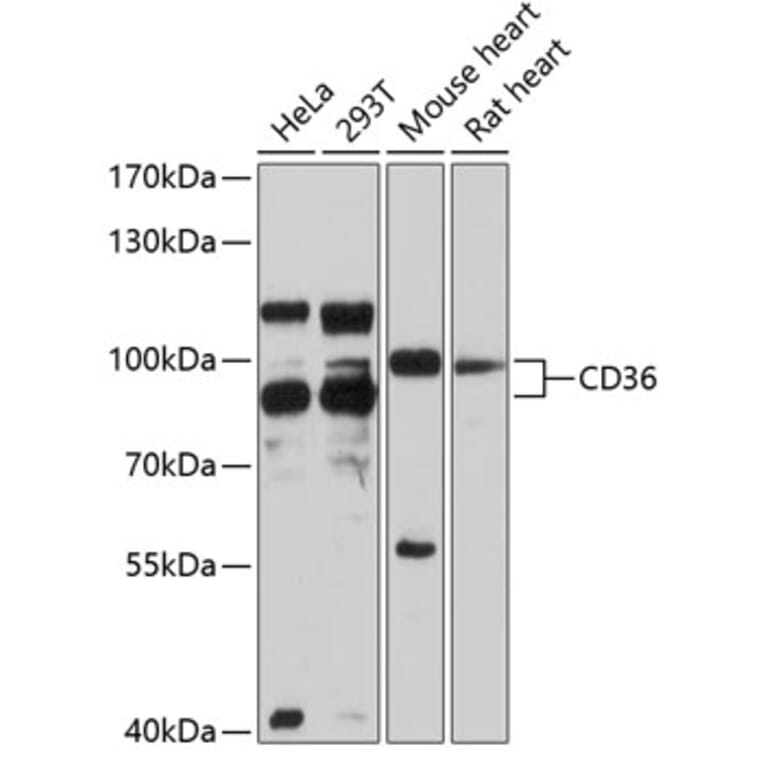 Western Blot - Anti-CD36 Antibody (A1470) - Antibodies.com