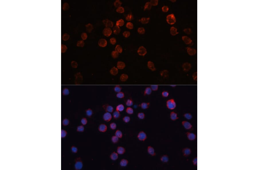 Immunofluorescence - Anti-CD36 Antibody (A1470) - Antibodies.com