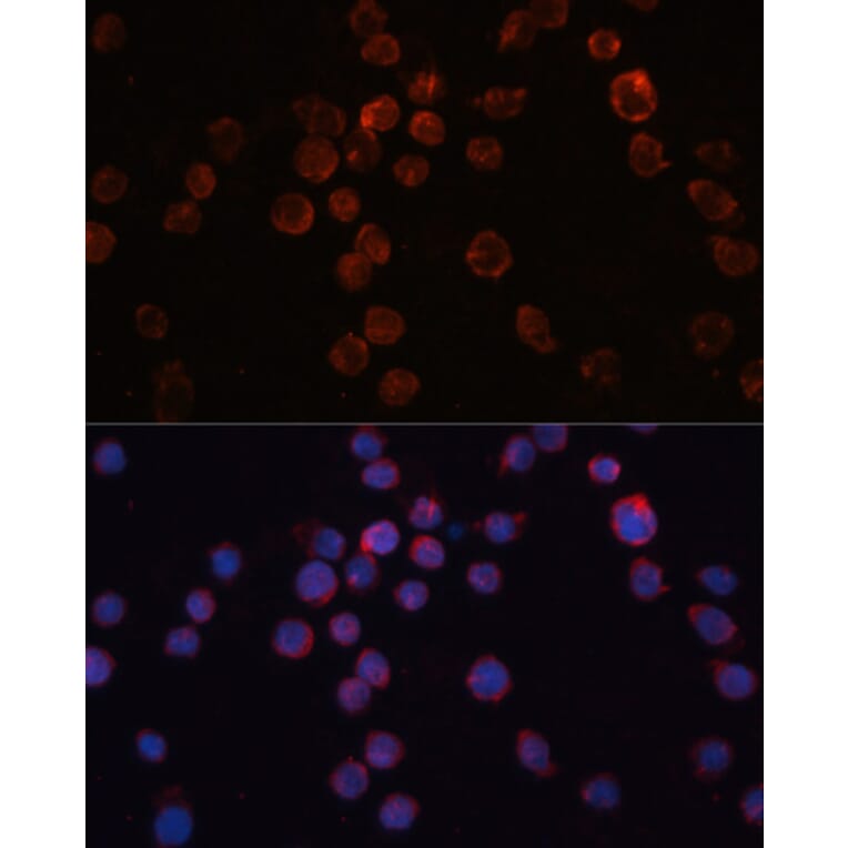 Immunofluorescence - Anti-CD36 Antibody (A1470) - Antibodies.com