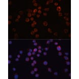 Immunofluorescence - Anti-CD36 Antibody (A1470) - Antibodies.com