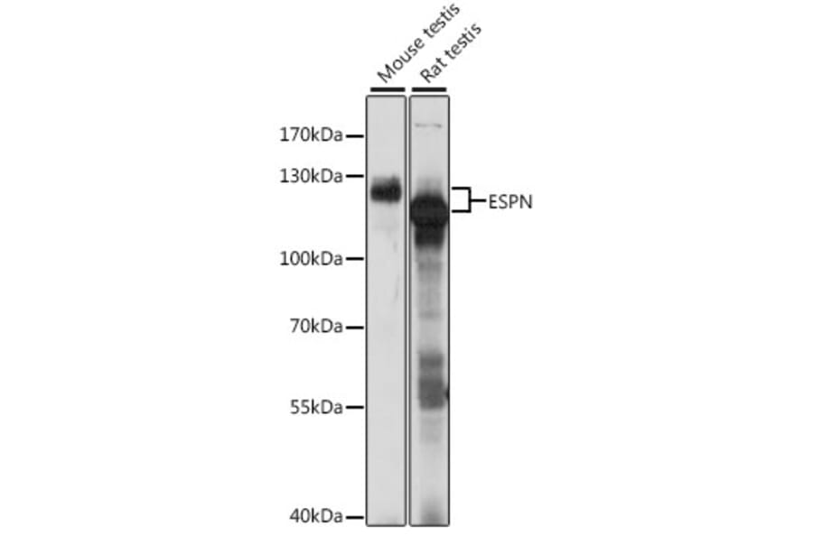 Western Blot - Anti-Espin Antibody (A87604) - Antibodies.com