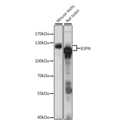 Western Blot - Anti-Espin Antibody (A87604) - Antibodies.com