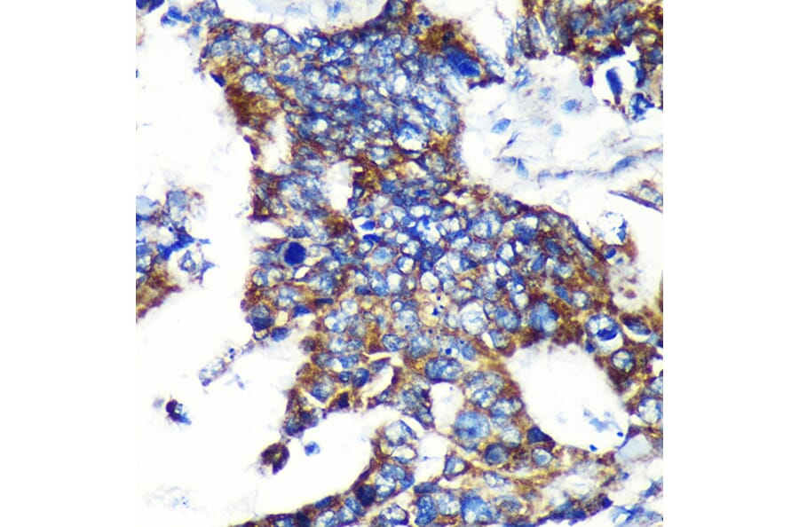 Immunohistochemistry - Anti-Espin Antibody (A87604) - Antibodies.com