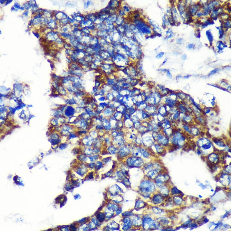 Immunohistochemistry - Anti-Espin Antibody (A87604) - Antibodies.com