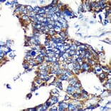 Immunohistochemistry - Anti-Espin Antibody (A87604) - Antibodies.com