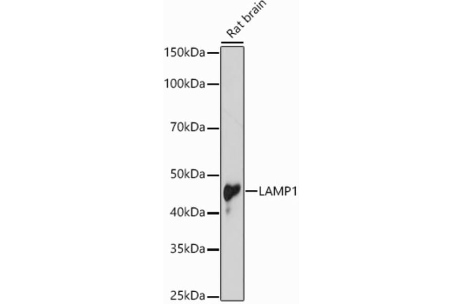 Western Blot - Anti-LAMP1 Antibody (A87605) - Antibodies.com