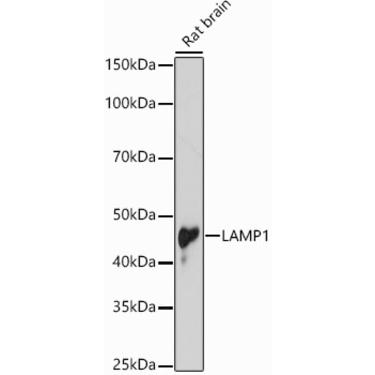 Western Blot - Anti-LAMP1 Antibody (A87605) - Antibodies.com