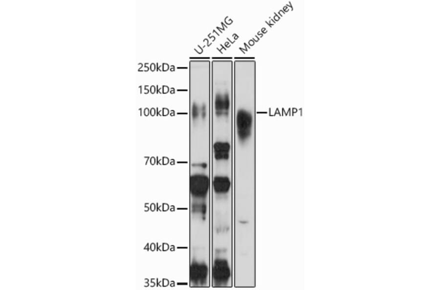Western Blot - Anti-LAMP1 Antibody (A87605) - Antibodies.com