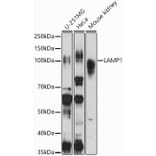 Western Blot - Anti-LAMP1 Antibody (A87605) - Antibodies.com