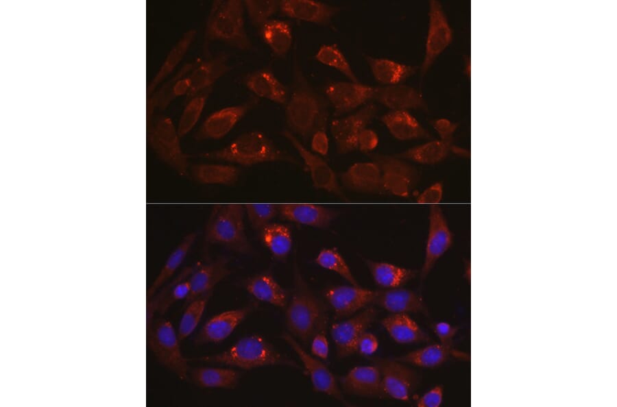 Immunofluorescence - Anti-LAMP1 Antibody (A87605) - Antibodies.com